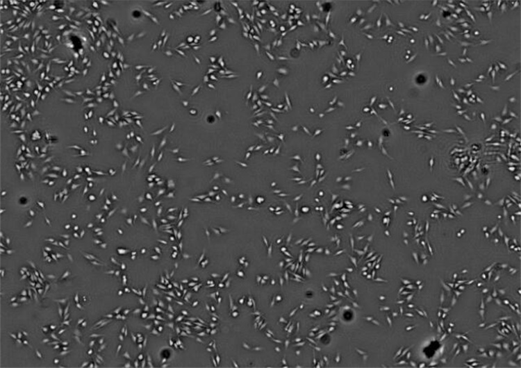 这是cytelive观测到的海拉细胞(宫颈癌细胞),单幅图像一亿像素,获得的